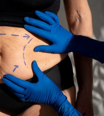 Liposuction Benefits