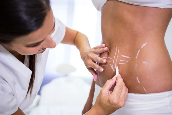 Non-Surgical Fat Reduction vs Liposuction: Which Is Right for You?
