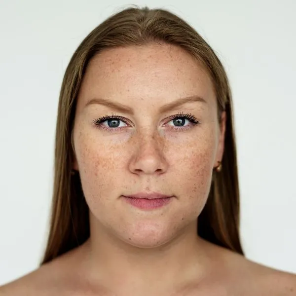  Pigmentation Isn’t One Problem: Identifying the Right Treatment