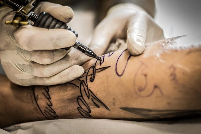 Laser Tattoo Removal: Does It Leave Scars?