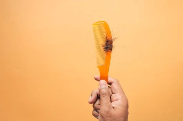 Why Am I Losing More Hair Than Usual? Causes & What to Do