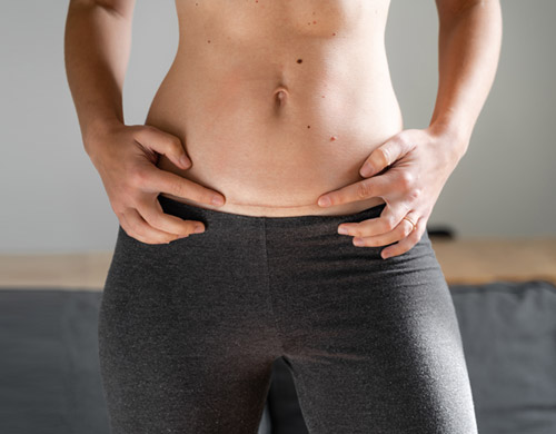 C-Section Scar Revision