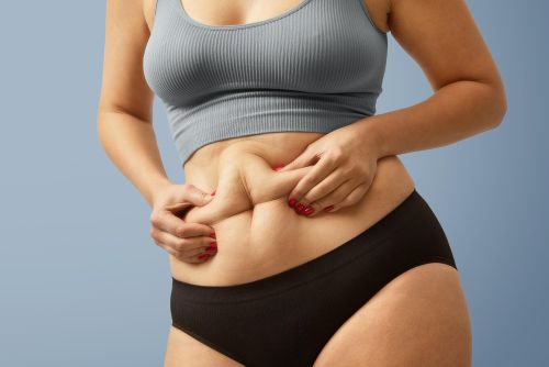 Liposuction Technique