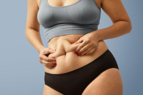 Tummy Tuck