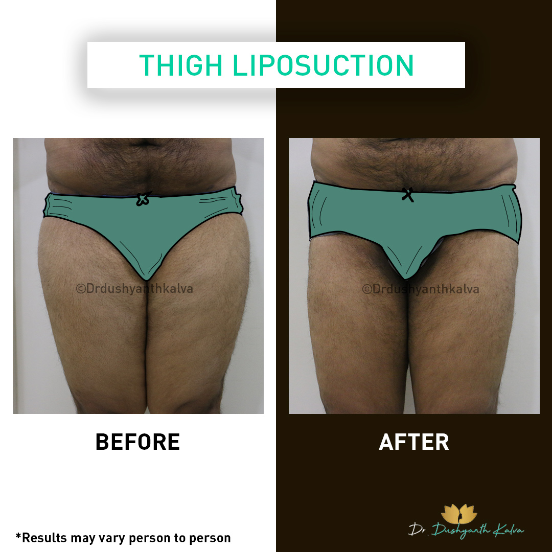 result 1 inner