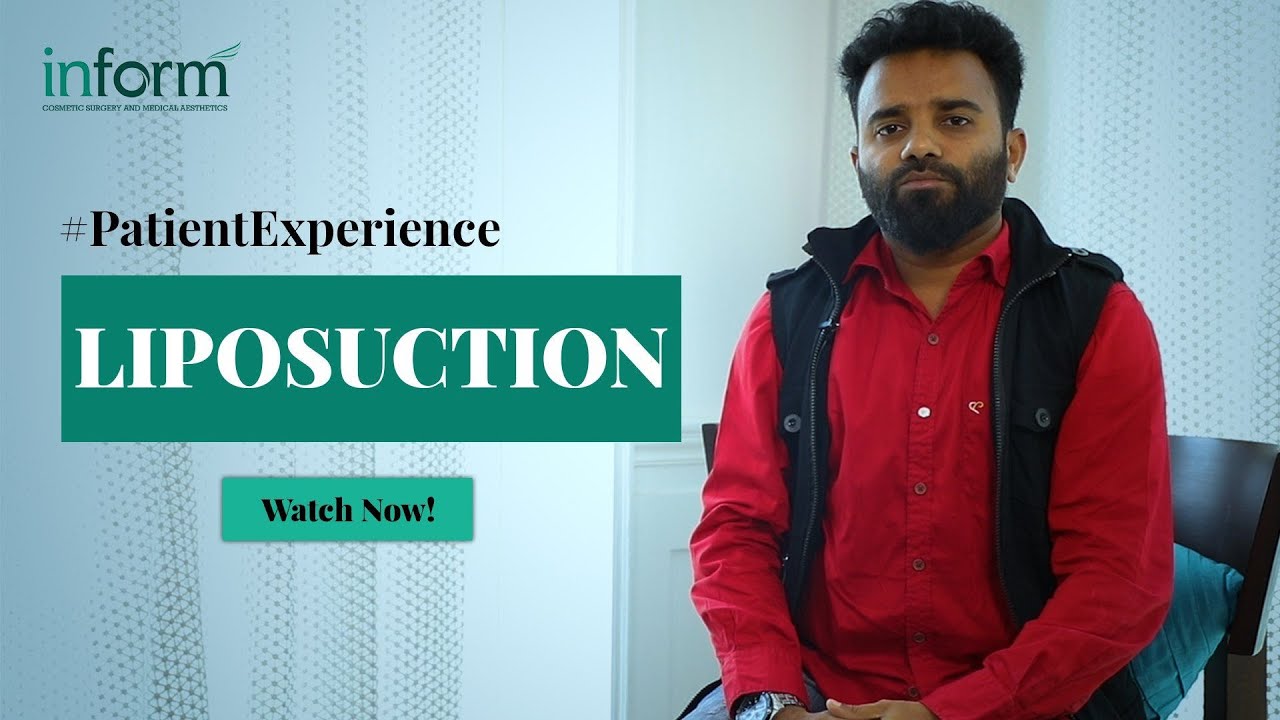How I lose my belly fat with Liposuction!